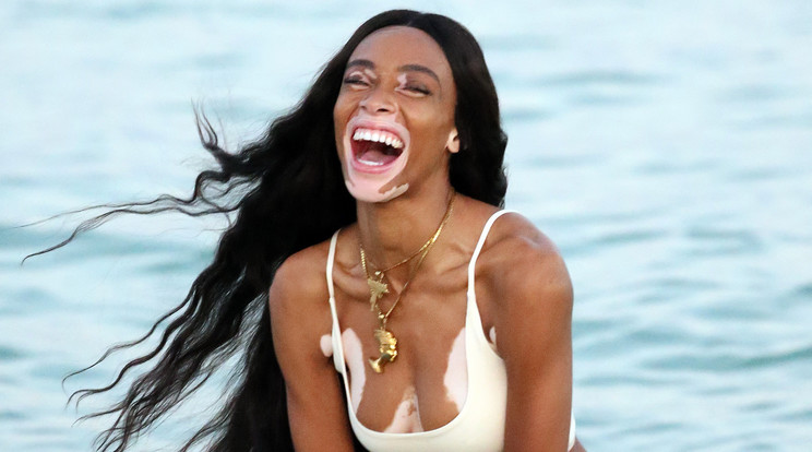 Winnie Harlow bikinifotózáson - Fotó: Northfoto