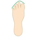 stopa grecka (drugi palec jest dłuższy od dużego palca)