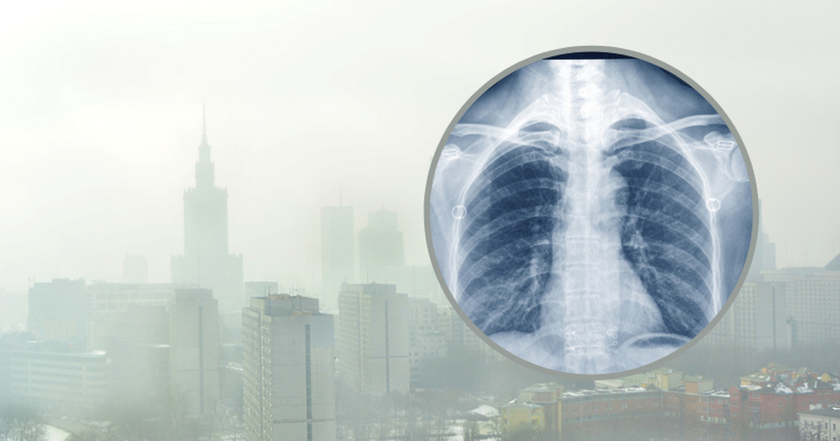 Jak chronić płuca przed smogiem? Dziewięć rad od pulmonologów