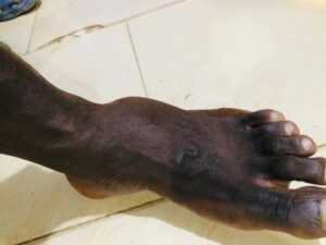 Armed robbers attack University of Ghana professor, 2 police officers injured