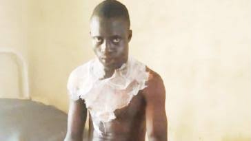 Newly-married man sets himself ablaze, blames wife’s abuse and curses