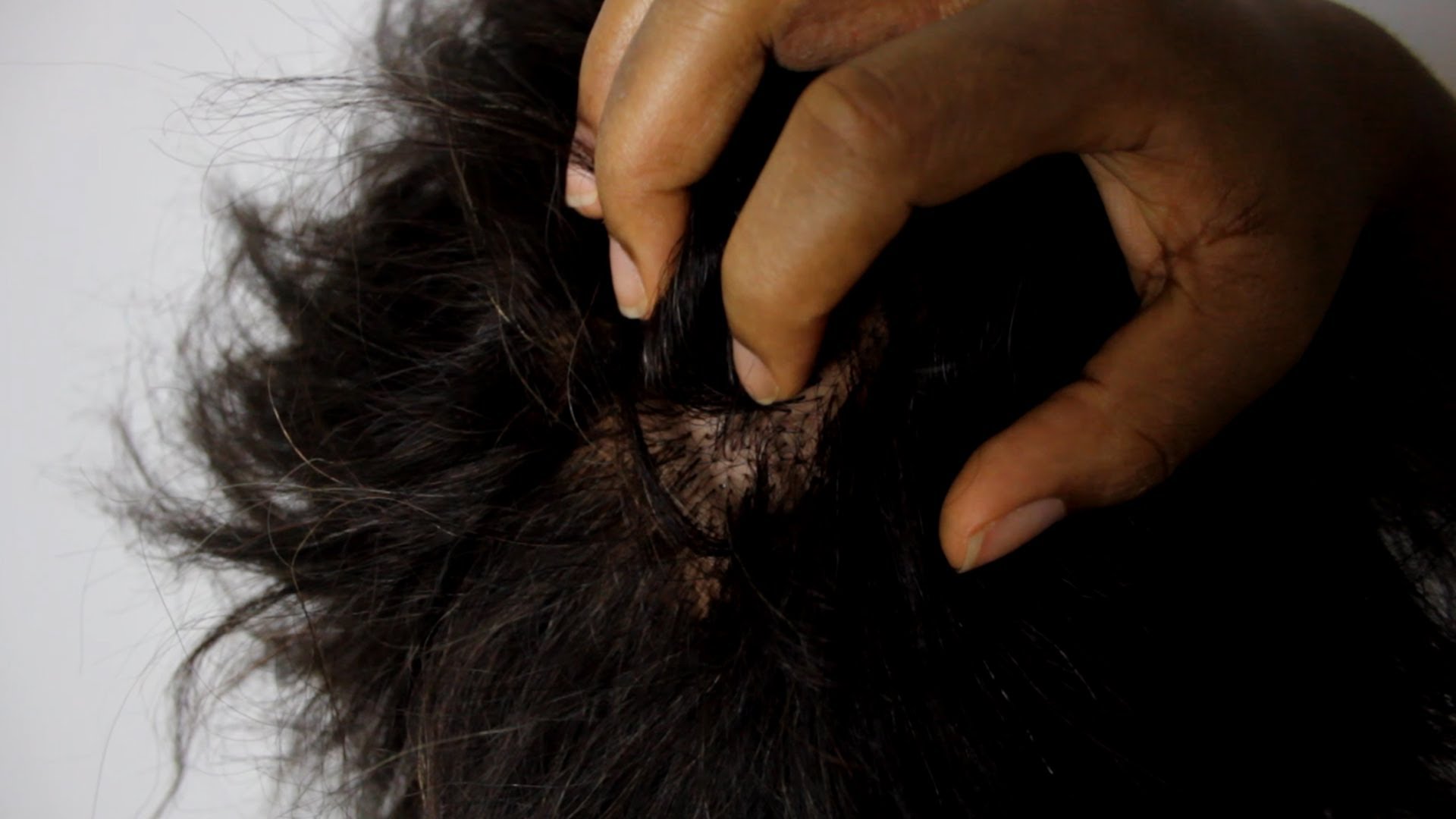 3 kitchen ingredients for itchy scalp | Pulse Ghana 3 kitchen ingredients for itchy scalp | Pulse Ghana