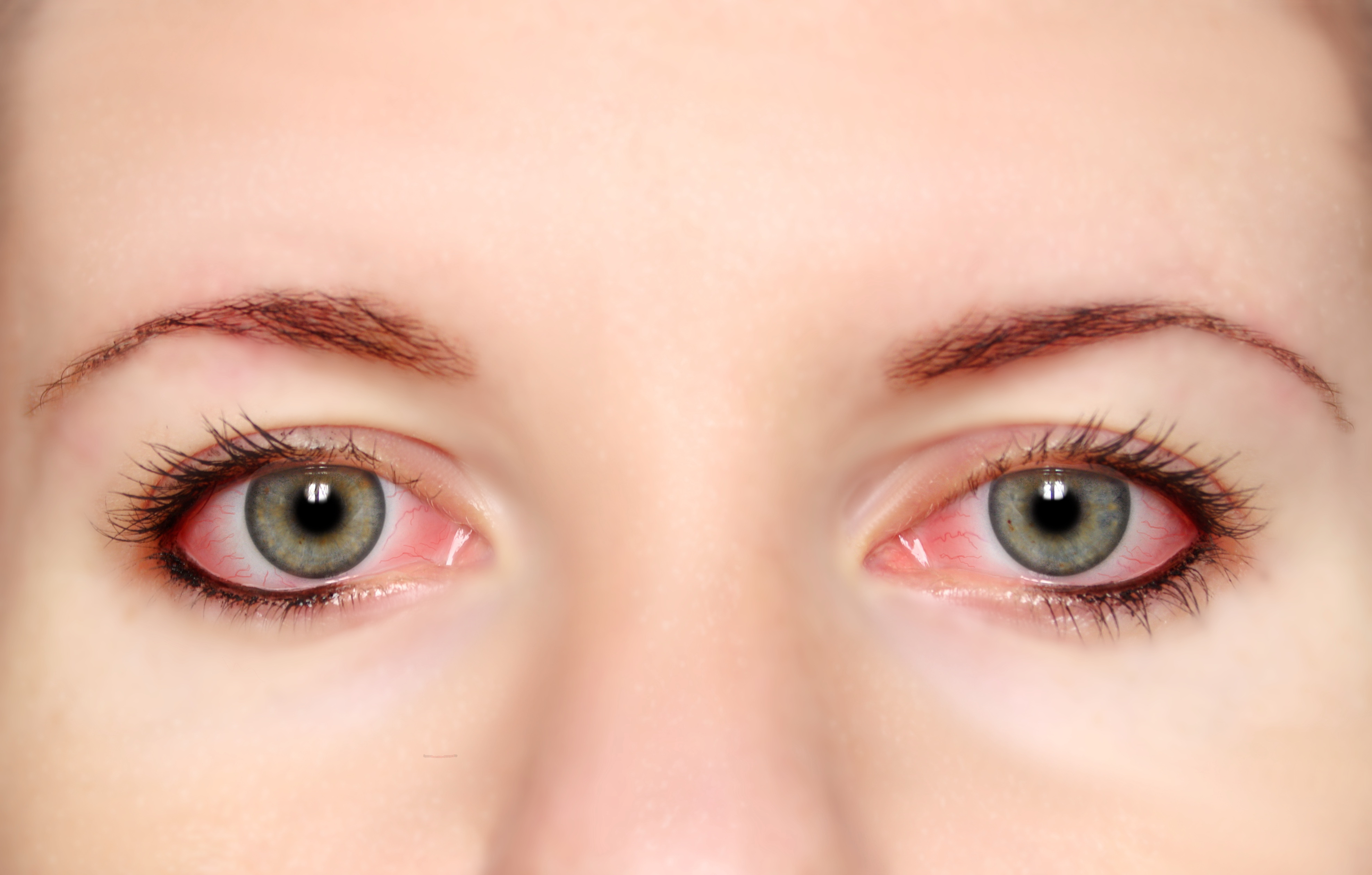 ízületi fájdalom vörös szem mi a csípőízületi kezelés