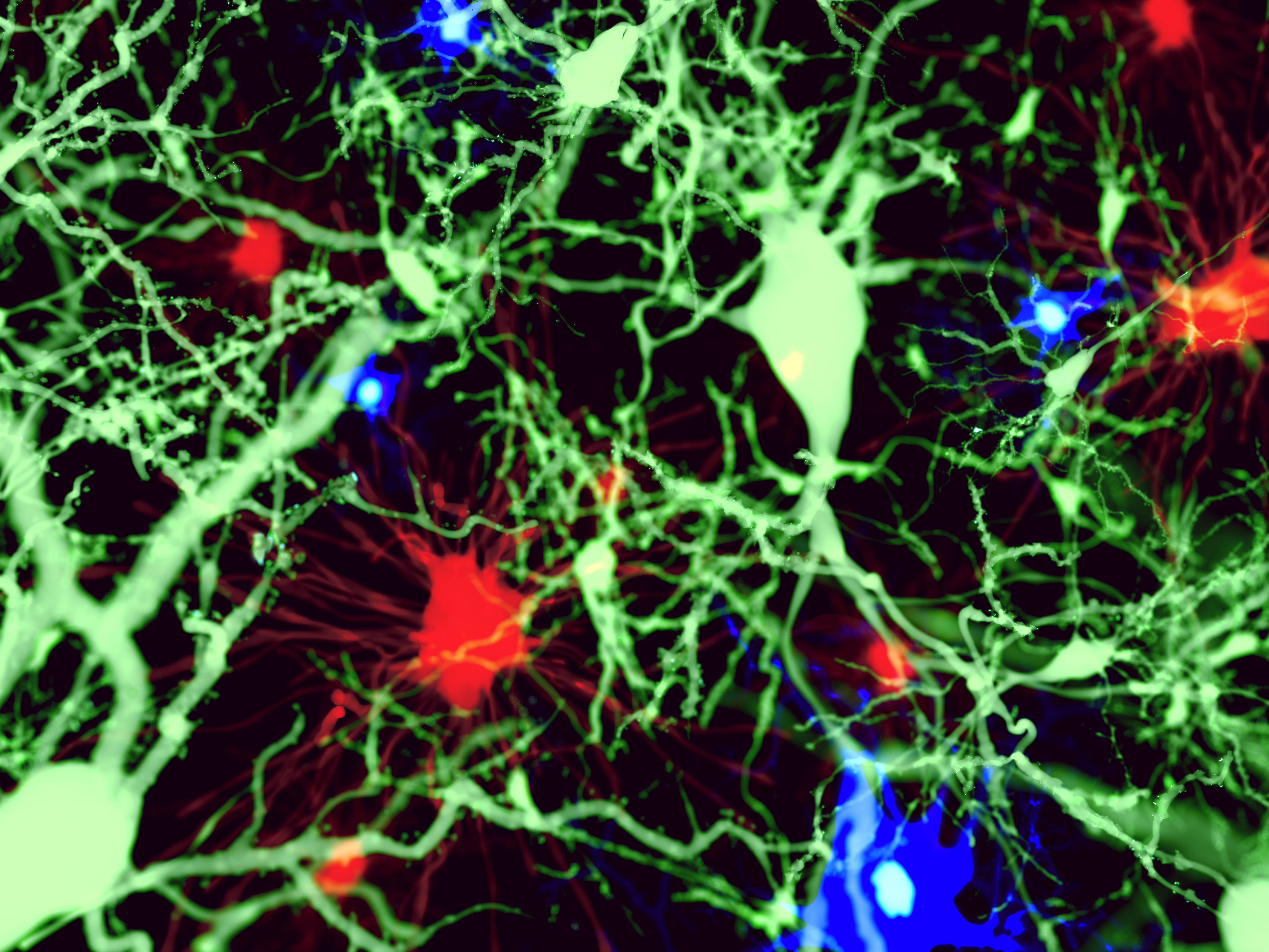 Астроциты мозга. Пирамидальные Нейроны. Клетки мозга фото. Веселый Нейрон. Жировые клетки в мозге.