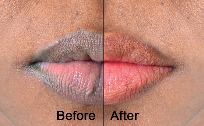 5 kitchen ingredients that you can use for pink lips | Pulse Ghana