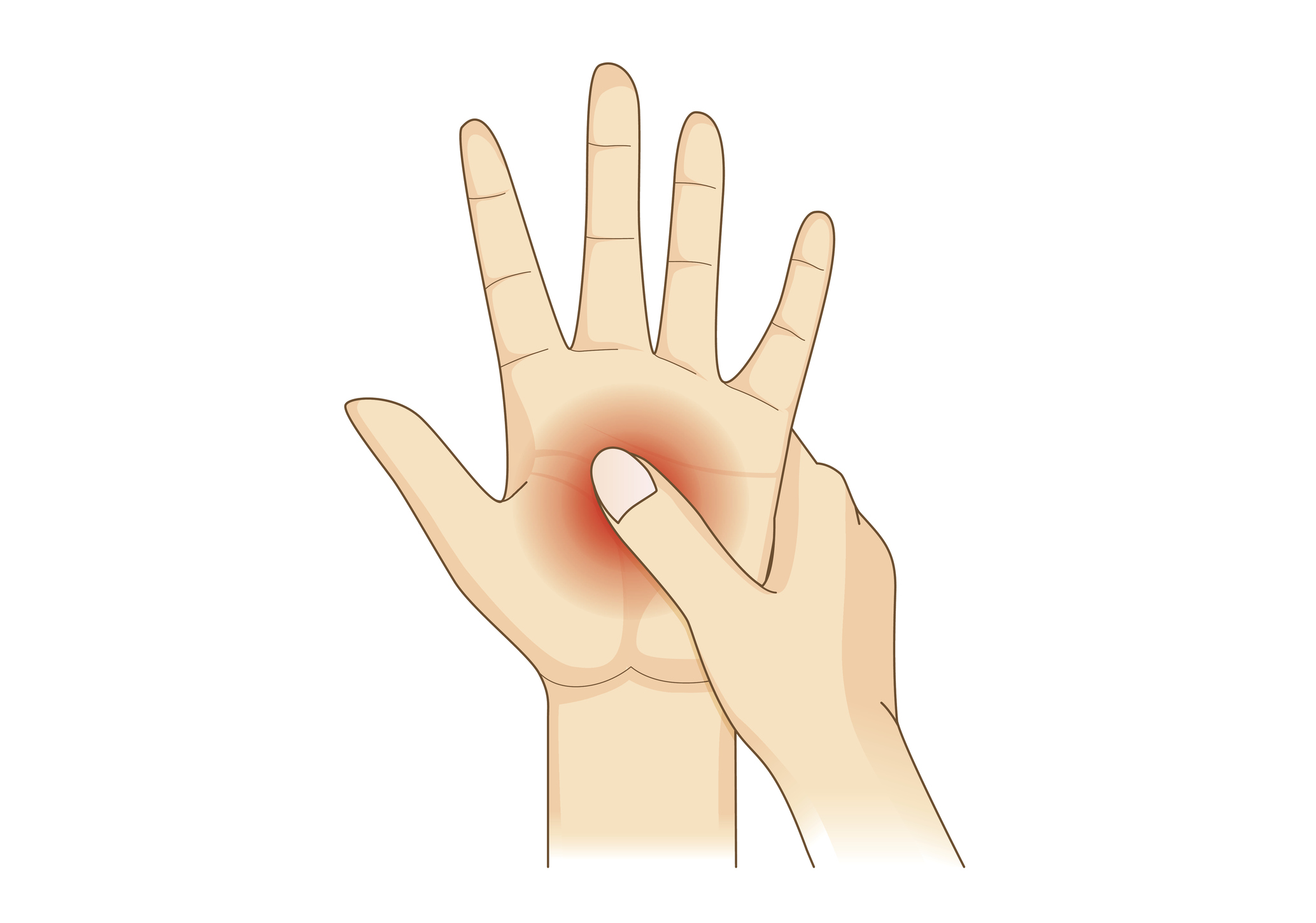 Ujjak és zsibbadások. Zsibbadás a kézben – az alagút szindróma tünetei
