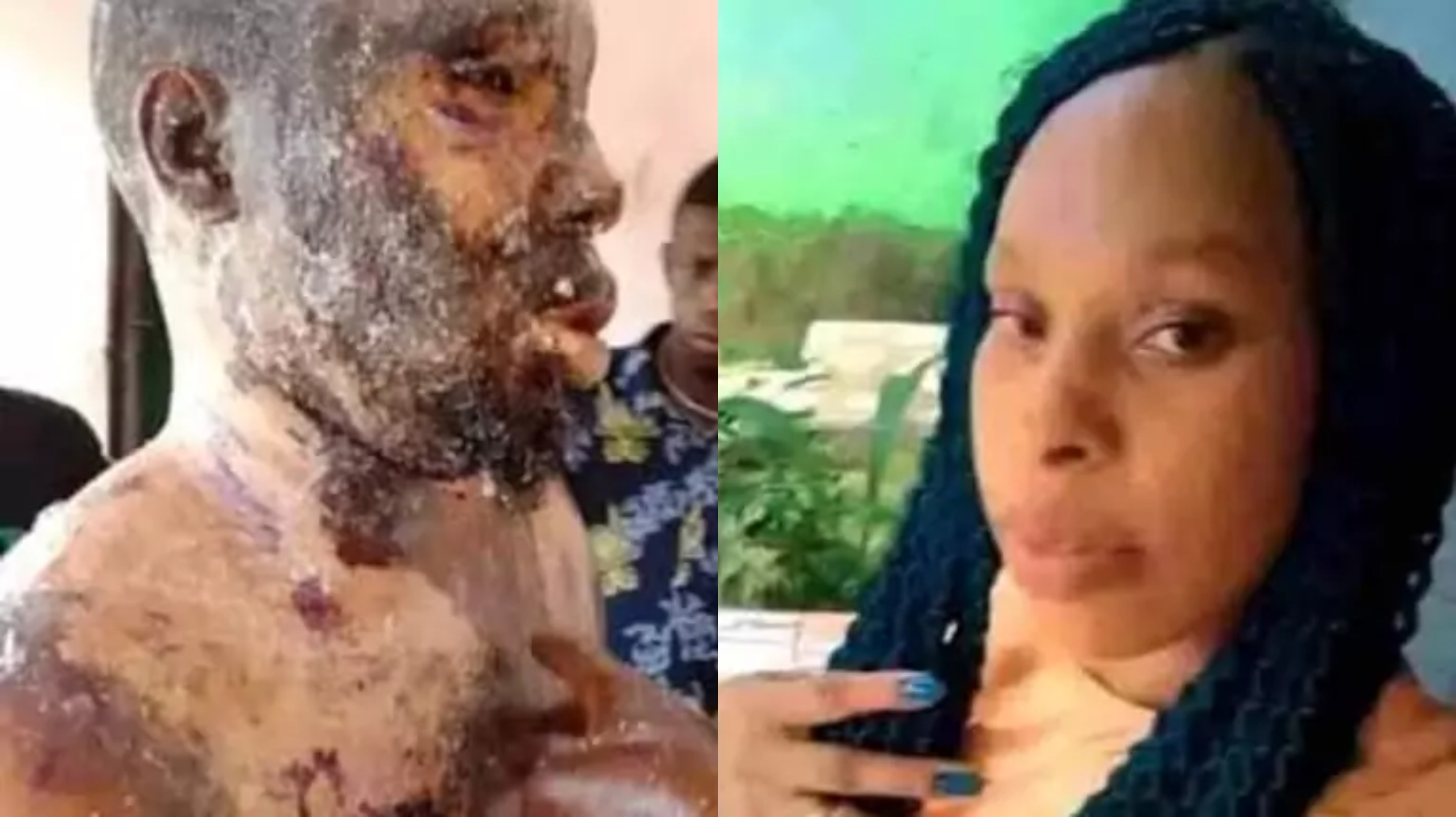 Wife arrested for pouring hot groundnut oil on husband