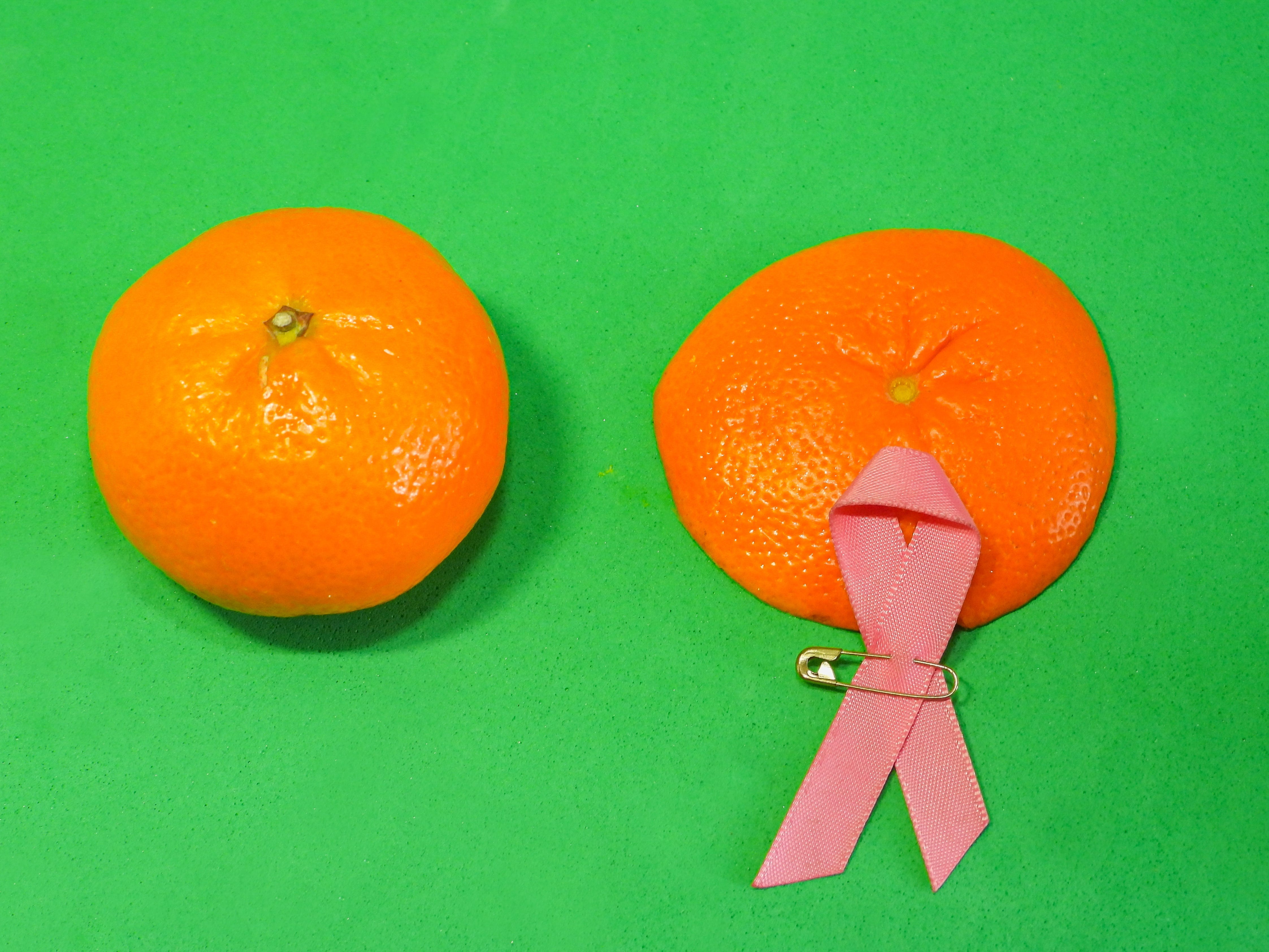 Breast cancer; Who is at risk and how to minimise your chances of getting it