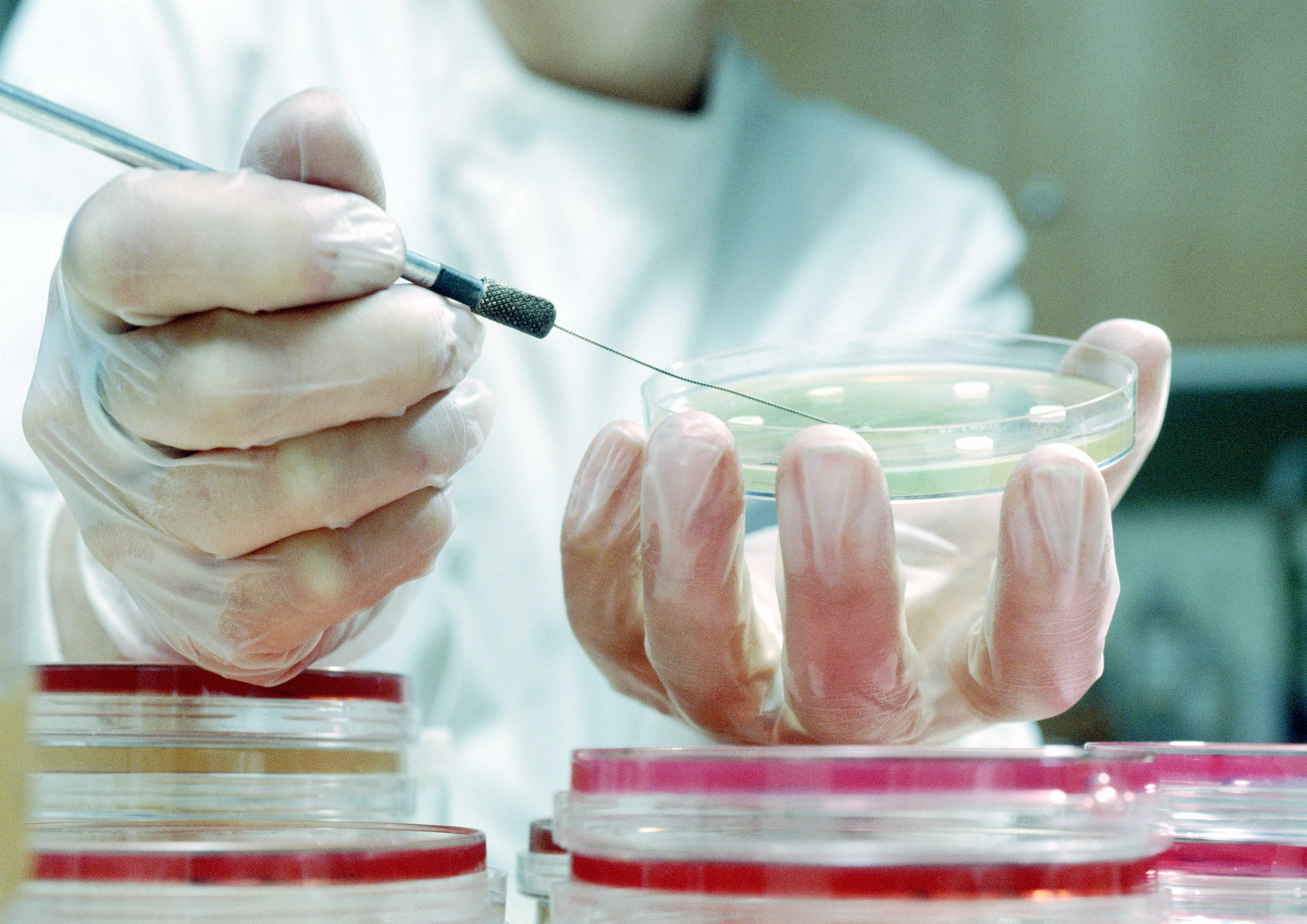 Оборудование бактериологической лаборатории. Бактериологическое исследование. Баклаборатория это. Оборудование микробиологической лаборатории. Оборудование бактериологической лаборатории.