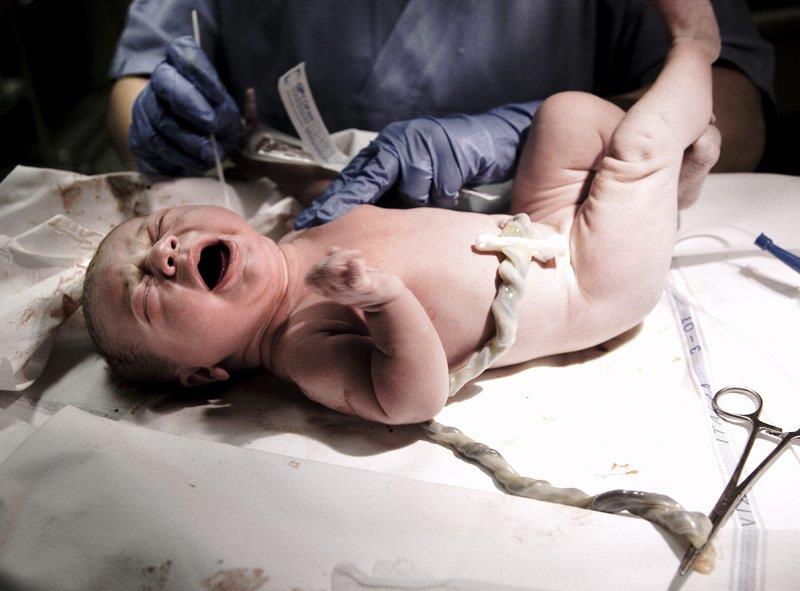 Dlaczego niektóre kobiety po porodzie zjadają łożysko? | Newsweek