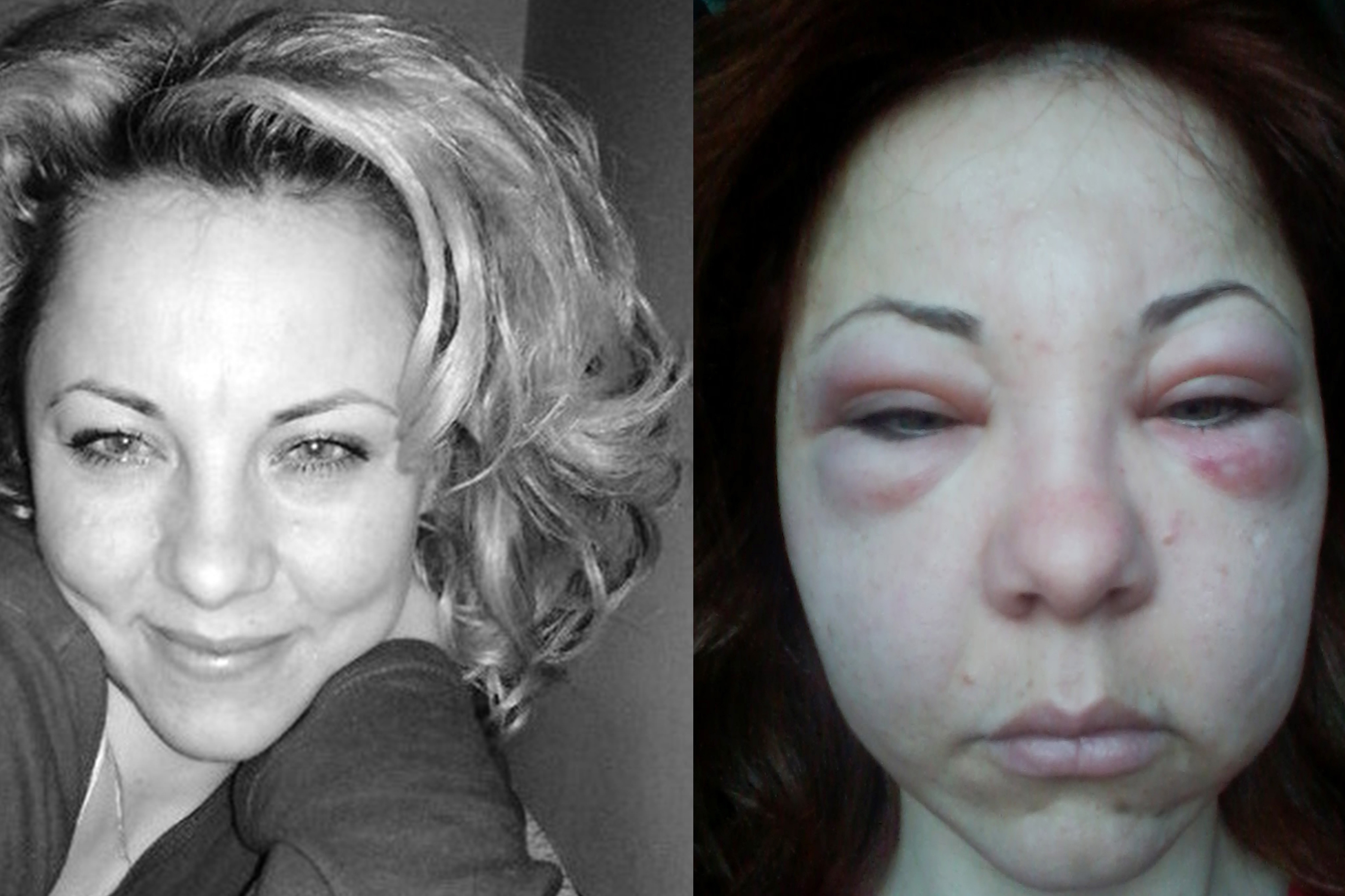 images Twarz Alkoholika Zdjęcia ofiara chirurga plastycznego ma