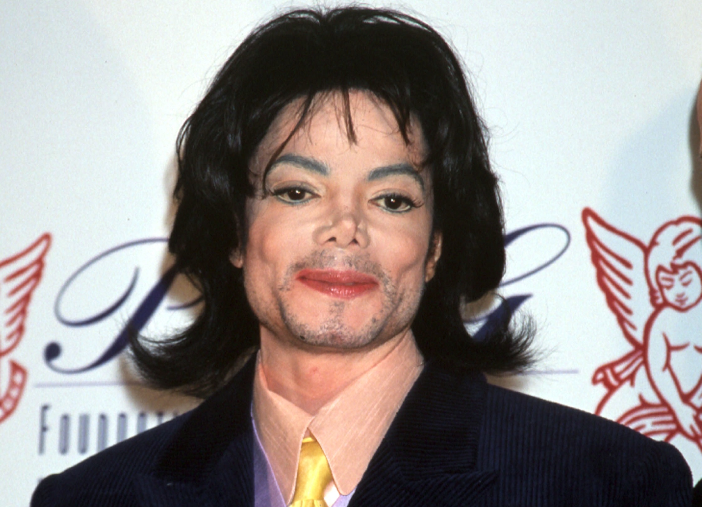 Майкл Джексон пластические операции провалился нос
