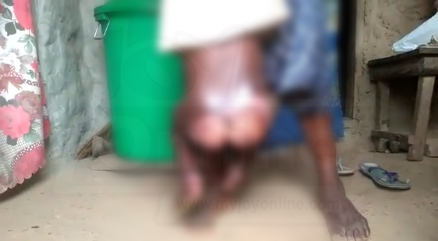 Ghanaian mother burns 4-year-old daughter in hot water over missing sandals