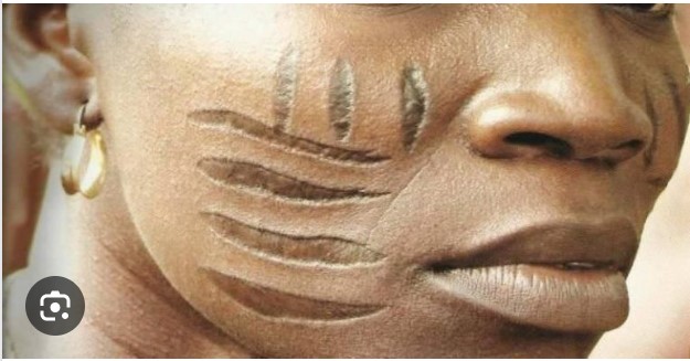 Why tribal marks were a thing and how to get rid of them