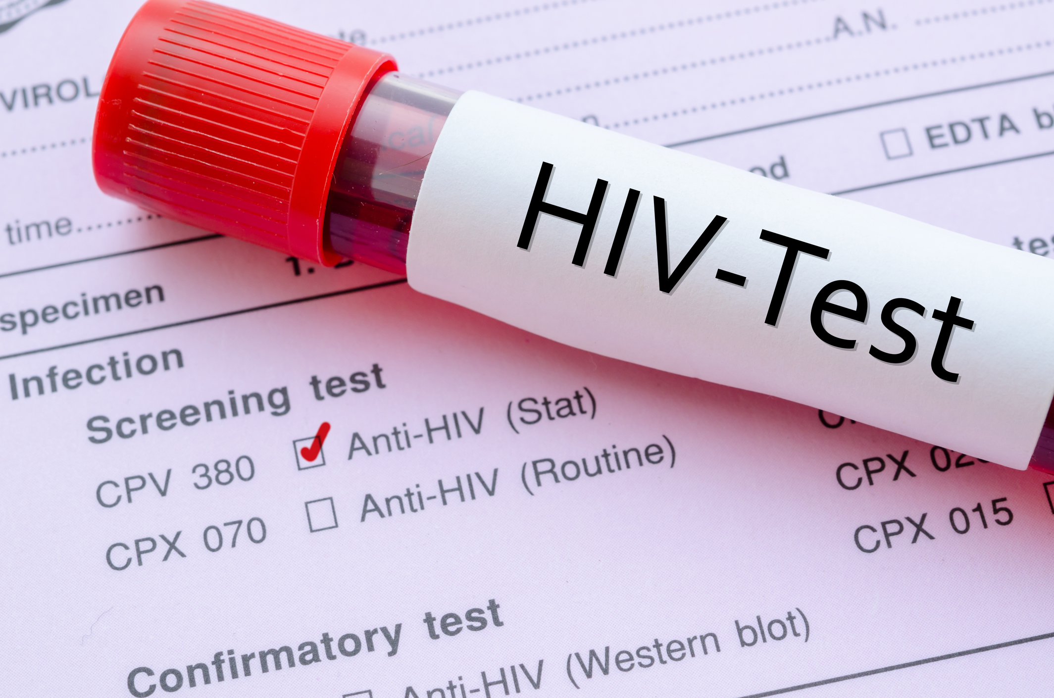 Заражение через тесты. ВИЧ. HIV. ВИЧ инфекция. HIV тест.