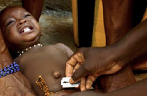 835,000 Ghanaian men uncircumcised — Ghana Statistical Service