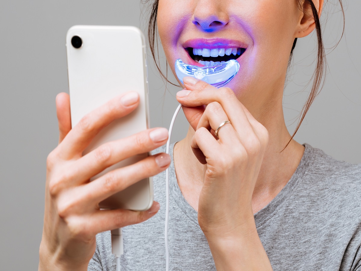 Zestaw do wybielania zębów — jak działa, jakie ma zalety? Wyjaśniamy! - Dom