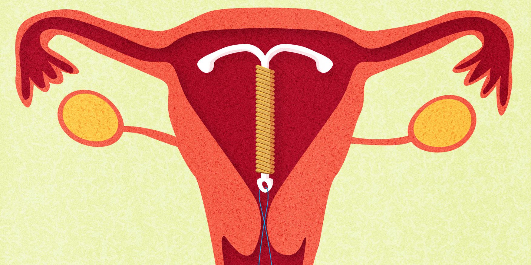 8 Things You Need To Know About Sex When You Have An IUD | Pulse Ghana