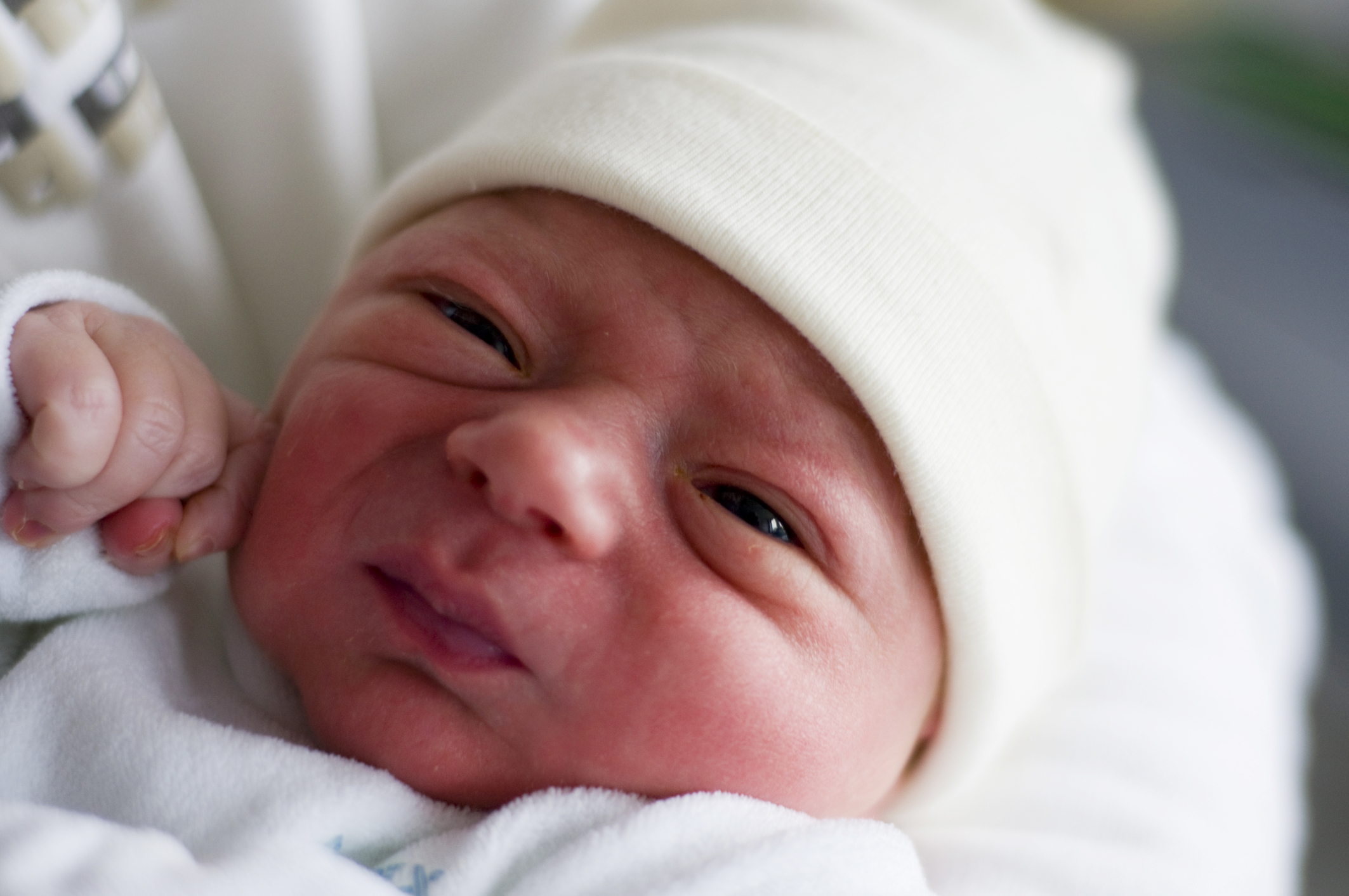 К новорожденному приходит врач. Глаза у новорожденных. Глаза новорожденного ребенка. Опухшие глаза у новорожденного. Новорождённые дети.