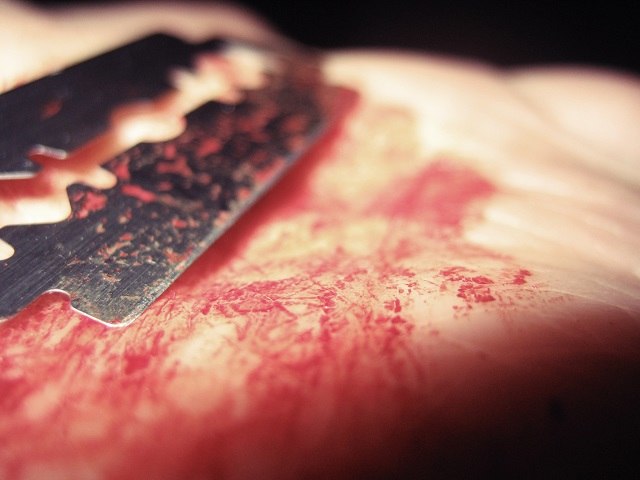 Husband in critical condition after wife cuts his penis with razor blade