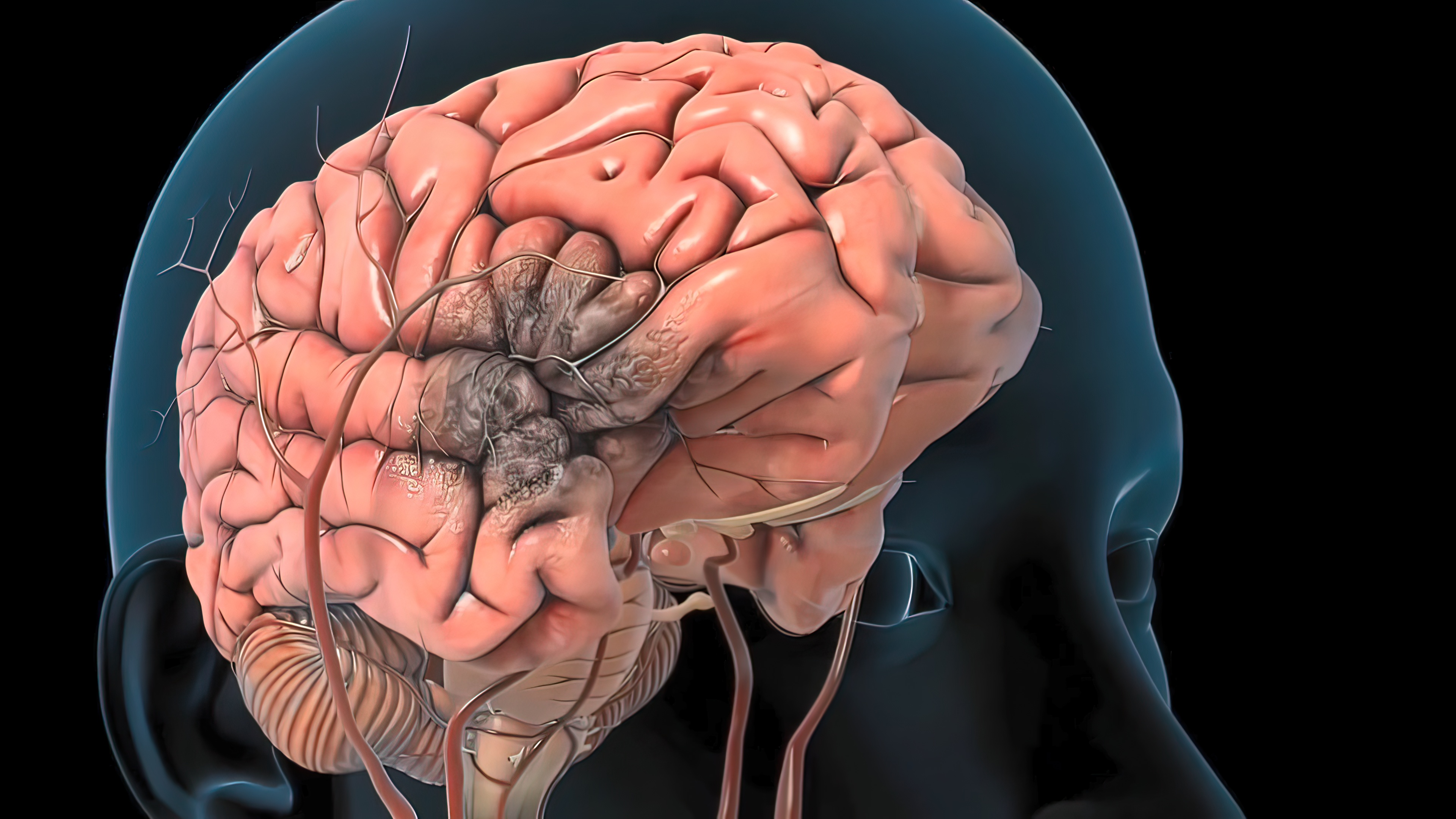Видео сосудов головного мозга. Инсульт. Ишемический инсульт анимация. Разрыв сосуда в головном мозге.