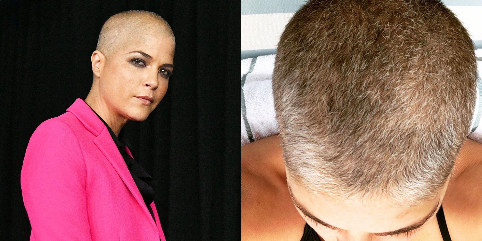 Selma Blair Shares Update On Hair Growth Amidst Multiple Sclerosis