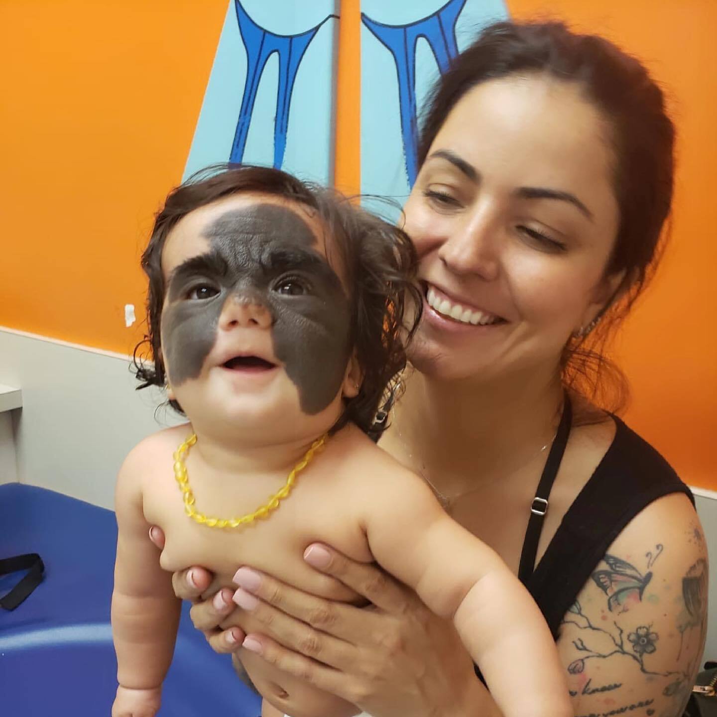 Луна фенер павел попов невус краснодар. Марианна мендес. Девочка луна с родимым пятном. Родимое пятно врожденное. Луна фенер павел попов невус краснодар.