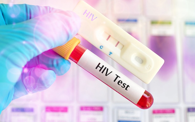 Over 20,000 Ghanaians test positive for HIV in first half of 2022