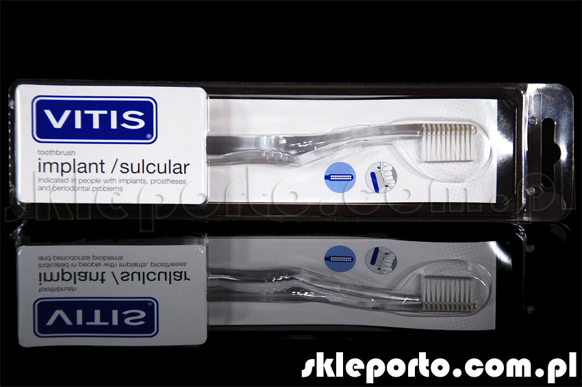 Vitis Dentaid Sulcular