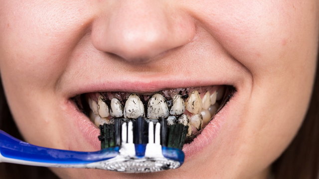 Czy warto stosować czarną pastę do zębów? Dentystka odpowiada