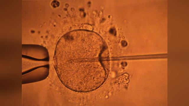 „Embriony to nienarodzone dzieci”. Po wyroku sądu w Alabamie kliniki wstrzymują terapię in vitro