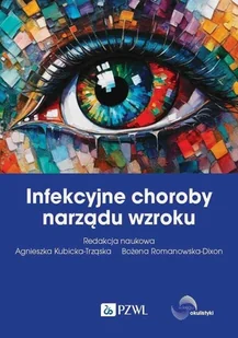 Infekcyjne choroby narządu wzroku - E-booki - nauka - miniaturka - grafika 1