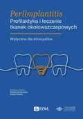 Książki medyczne - Periimplantitis. Profilaktyka i leczenie tkanek okołowszczepowych - miniaturka - grafika 1