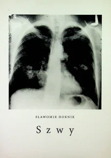 Szwy - Poezja - miniaturka - grafika 1