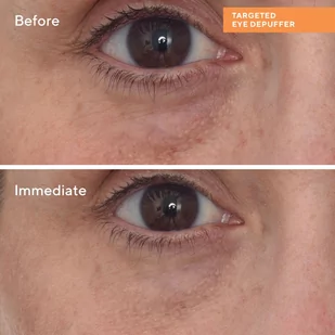 Murad Kuracja pod oczy Targeted Eye Depuffer - Kosmetyki pod oczy - miniaturka - grafika 4