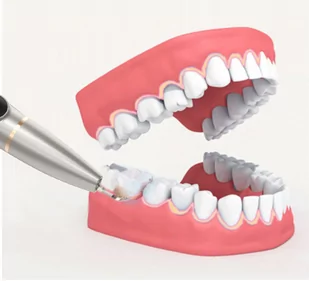 Skaler Dentystyczny z Kamerą i Latarką Ultradźwiękowy Braders - Pozostałe urządzenia kosmetyczne - miniaturka - grafika 9