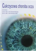 Książki medyczne - Cukrzycowa choroba oczu - miniaturka - grafika 1