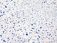 Meble modułowe i akcesoria - Klejowa Okleina Meblowa Niebieskie Lastryko Na Regał Meble Blat 67x100 - miniaturka - grafika 1