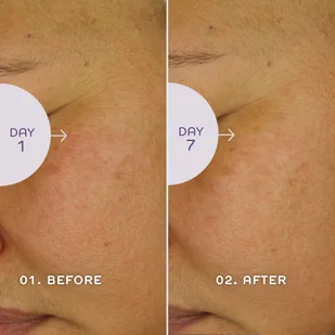 REN Clean Skincare REN Clean Skincare Bio Retinoid Youth Serum serum do twarzy 30 ml - Serum do twarzy - miniaturka - grafika 5