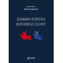 Złamania wyrostka kłykciowego żuchwy - Książki medyczne - miniaturka - grafika 1