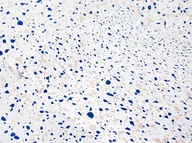 Meble modułowe i akcesoria - Klejowa Okleina Meblowa Niebieskie Lastryko Na Regał Meble Blat 67x100 - miniaturka - grafika 1