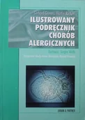 Książki medyczne - Ilustrowany podręcznik chorób alergicznych - miniaturka - grafika 1