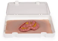 Sprzęt ratunkowy - Erler-zimmer Rana Wyjście z rany z jelita cienkiego - miniaturka - grafika 1
