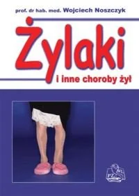 Żylaki i Inne Choroby Żył - Zdrowie - poradniki - miniaturka - grafika 1