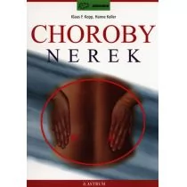 Choroby nerek - Kopp Klaus F., Keller Hanne - Zdrowie - poradniki - miniaturka - grafika 1