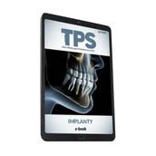 Książki medyczne - Implanty (e-book) [pdf] - miniaturka - grafika 1