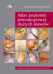 Blanco Moreno C. Atlas anatomii artroskopowej dużych stawów - mamy na stanie, wyślemy natychmiast - Pozostałe książki - miniaturka - grafika 1