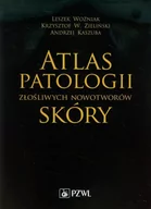 Podręczniki dla szkół wyższych - Wydawnictwo Lekarskie PZWL Atlas patologii złośliwych nowotworów skóry - Woźniak Leszek, Krzysztof Zieliński, Kaszuba Andrzej - miniaturka - grafika 1