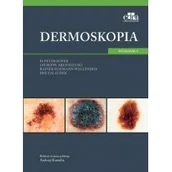 Książki medyczne - Dermoskopia - miniaturka - grafika 1