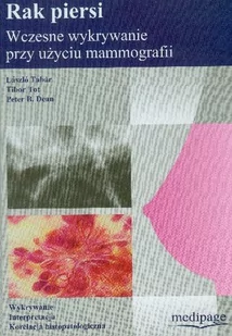 Medipage Wydawnictwo Medyczne Rak piersi - wczesne wykrywanie przy użyciu mammografii - Książki medyczne - miniaturka - grafika 1